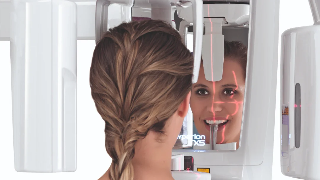 MyRay Hyperion X5 2D3D 1