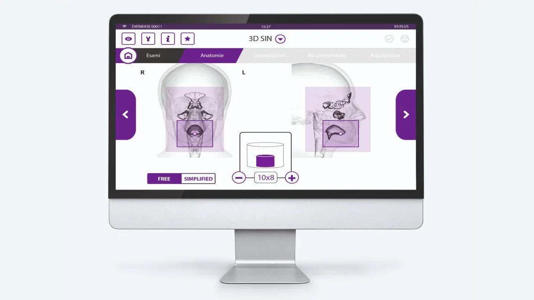 MyRay Hyperion X5 2D3D 3